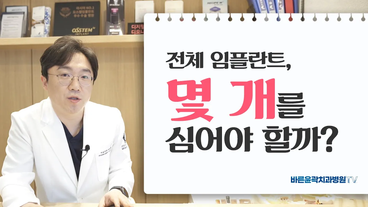 전체 임플란트, 몇개를 심어야 할까?